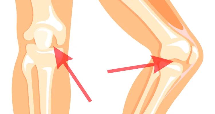 Nonsurgical treatment for knee joint pain