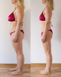 iV Therapy Before and After Near Ravenswood