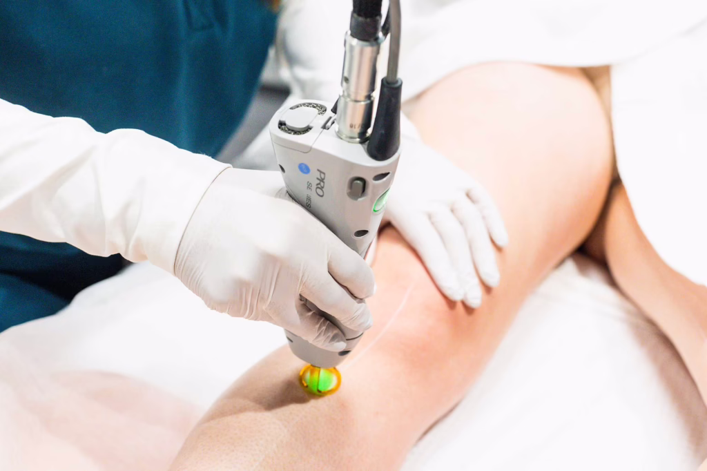 Laser Hair Removal Leg Near Raleigh, NC